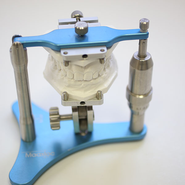 Kiefergelenksdiagnostik